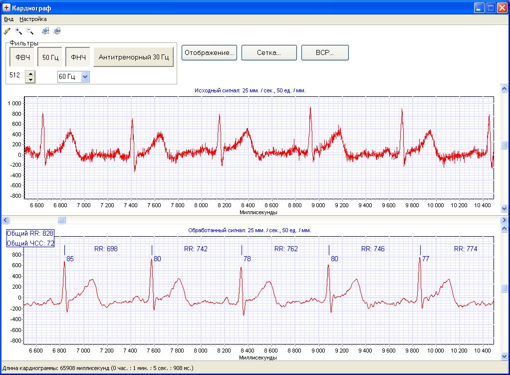 Guardian Client Cardio