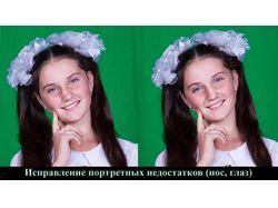 Нос