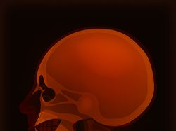 Векторная иллюстрация "Рентген черепа"