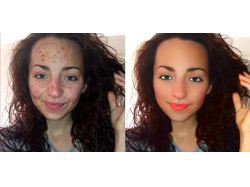 Улучшение лица