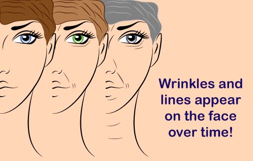 wrinkles.png