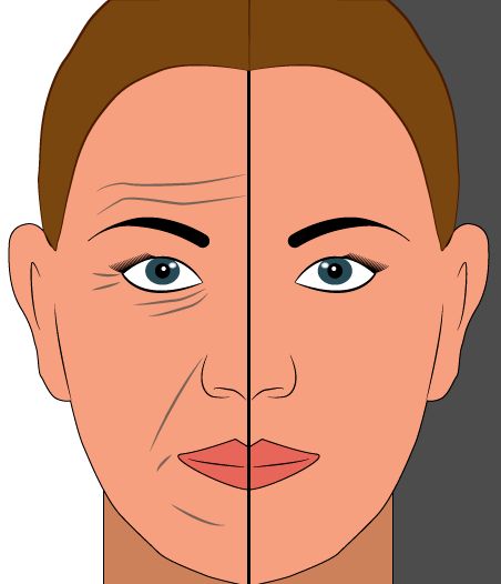 wrinkles_1.png