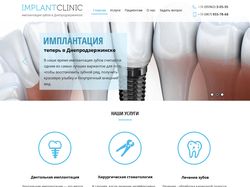 Сайт стоматологической клиники Implant Clinic