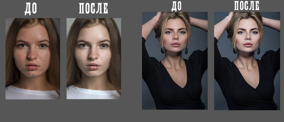 Алена гаврилова фото до и после пластики