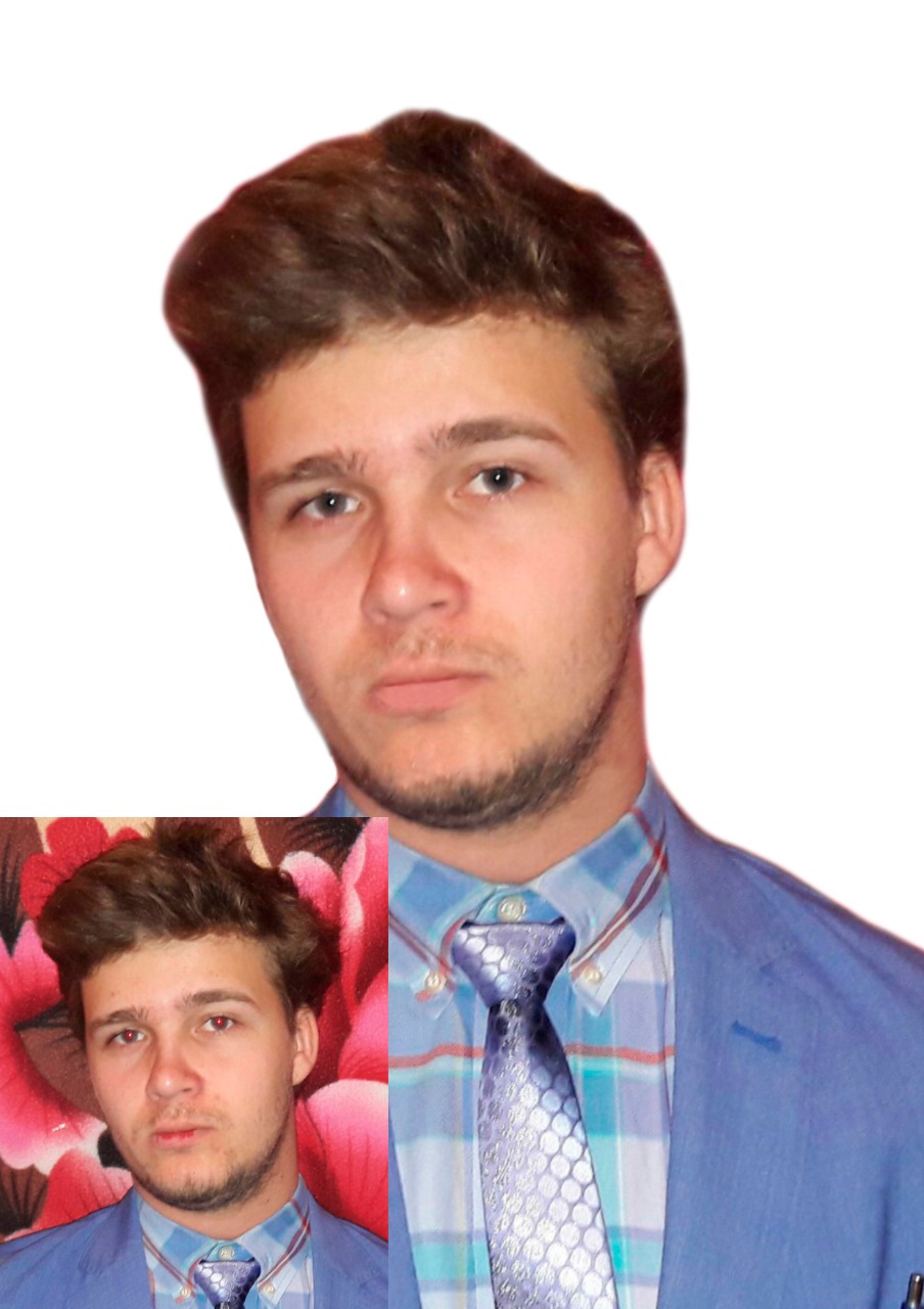 Фон, красные глаза, обветренные губы, пятна на лице.jpg