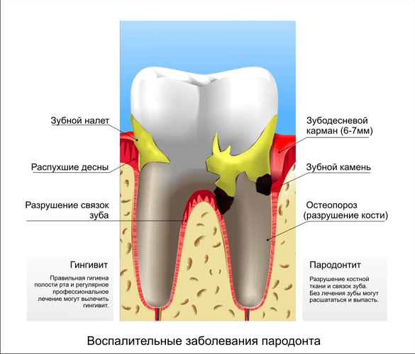 Плохой зуб(вектор).jpg