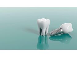 Лиды для стоматологической клиники