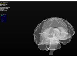 Мозг человека в 3D.