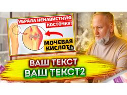 превью ютуб