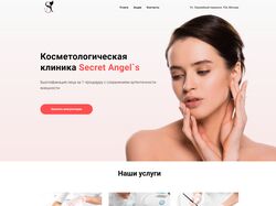 Secret Angel`s