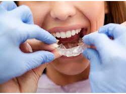 Orthodontist Farmington CT