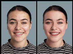 Retouch 