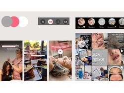 Визуальный кейс моей работы с доктором косметологом