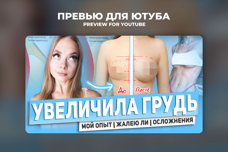 увел груди 2.jpg