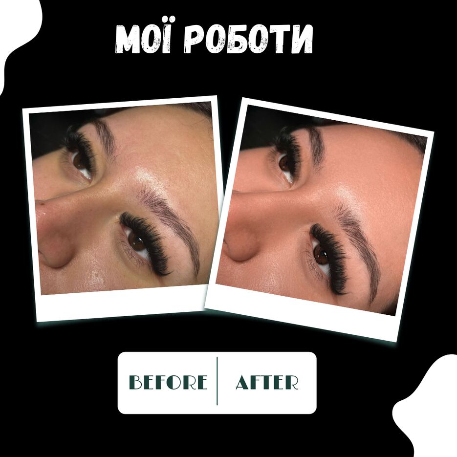 Free post comparison before and after beauty (2).png
