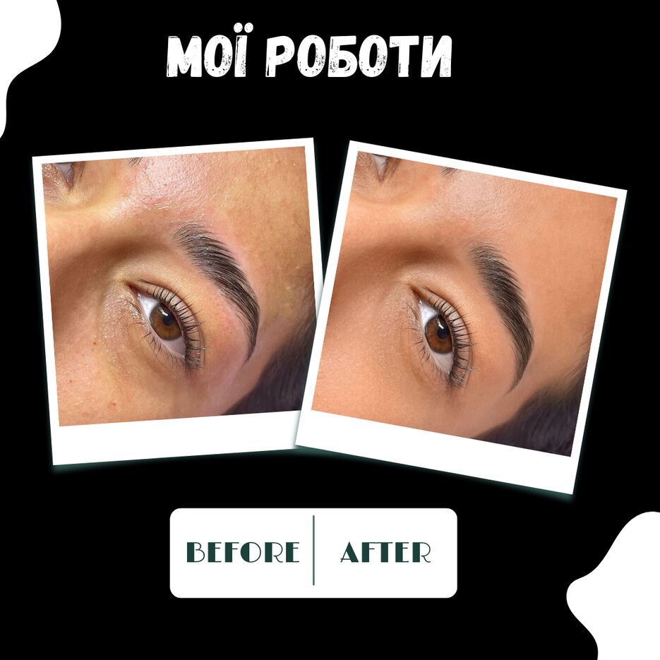 Free post comparison before and after beauty (3).png