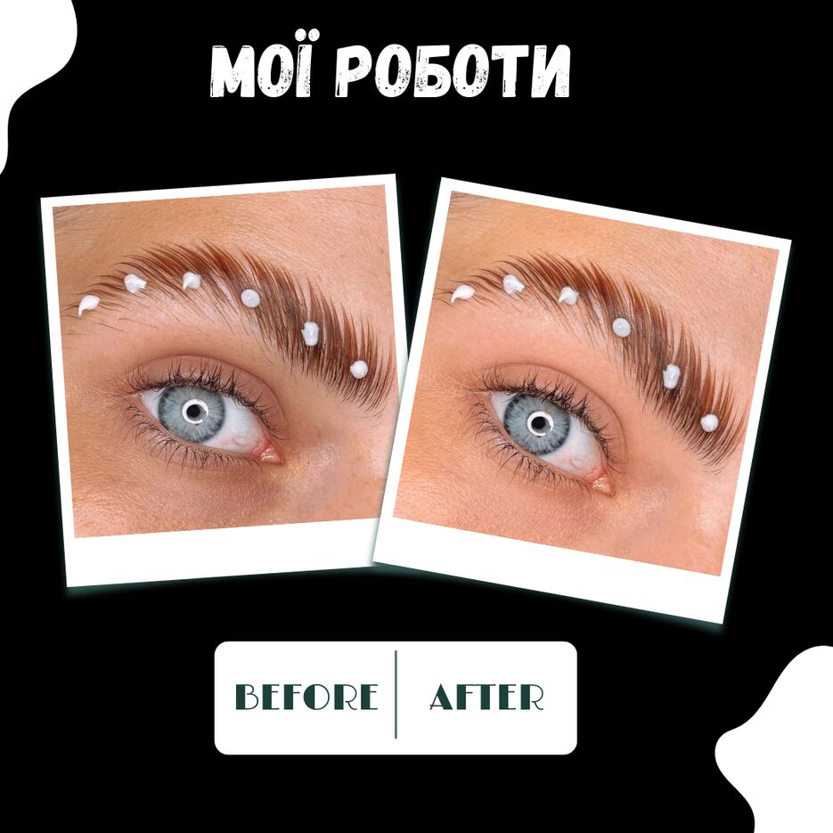 Free post comparison before and after beauty.png