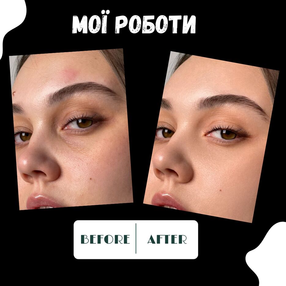 Free post comparison before and after beauty (4).png