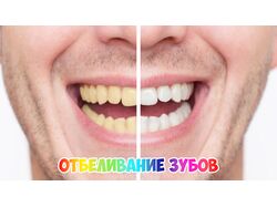 Белые зубы на фотографии