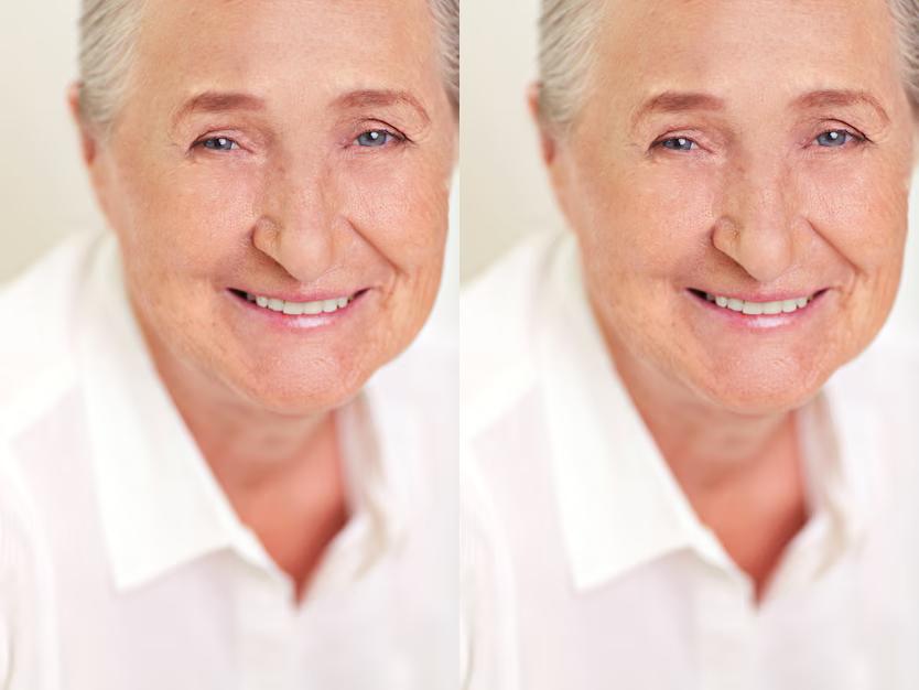 collage_before_after_custom.jpg