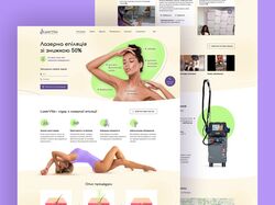 Лазерна епіляція